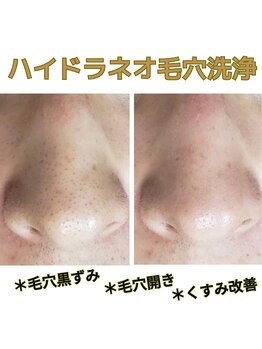 ココロ(COCORO)/大人気♪毛穴の大掃除