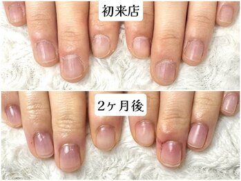 グラシナ 鳥丸店の写真/京都烏丸で叶う、自爪風長さ出しと徹底ケア！二枚爪・乾燥レス美爪へ☆