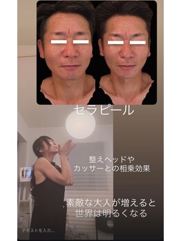 ジーニー(Genie)/セラピール