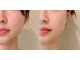タオ(TAO)の写真/【理想のフェイスラインに】小顔矯正といえばコルギ♪韓国由来の施術でリフトUP◎痛気持ちいいで効果を実感