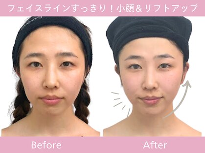 小顔フェイスラボ 那覇店(小顔 Face Labo.)の写真