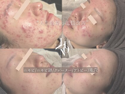 ルノン 天神店(LUNON)の写真