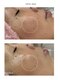 サロン アンジュ(salon.anju)の写真/隠れ毛穴も徹底ケア！ハーブピーリングで理想の透明美白肌を叶えるエステ◎（40文字）