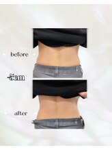 カリス(charis)/Before&After