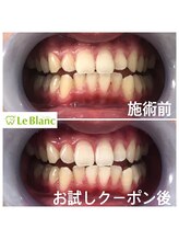 ルブラン 奈良店(Le Blanc)/最初はお試しのつもりが