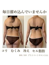 コア(CORE)/ガチガチ肩コリもお任せください