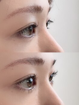 シューナランド(schoner Rand)/上下ラッシュリフト