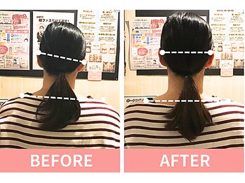 北浦和整体院/～ビフォーアフター～肩こり解消