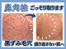 毛穴屋