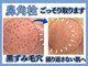 毛穴屋の写真