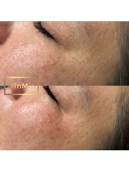 リア プラスマウナ(Li'a +MAUNA)/パーツWax 目の周り