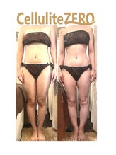 ラクワン(R coin)/