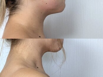 ネイル リリ(nail RiRi)/