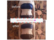 テヤン(Taeyang.)の雰囲気（【BeforeAfter】【40代女性】一度の施術の結果です◎）