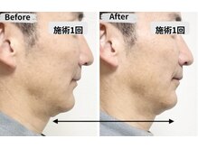 マリア(MALIA)/南森町で横顔すっきり