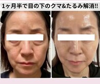 アディス 心斎橋(ADISE)