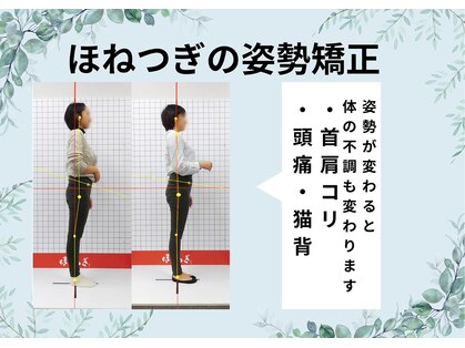 ほねつぎ長嶺鍼灸接骨院の写真