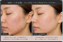 健香癒(けんこうゆ)