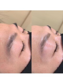 トータルビューティー ハナコ/メンズアイブロウ