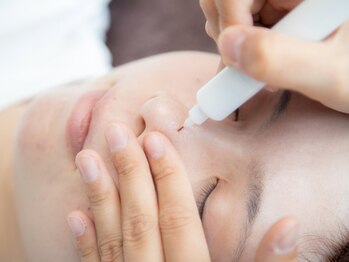 パルサロン(palsalon.)/シミケアの様子