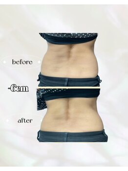 カリス(charis)/Before&After