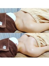 コモド(COMODO)/バストアップbefore&afterに注目