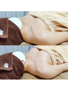 コモド(COMODO)/バストアップbefore&afterに注目