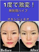 スペチアーレ 夙川/美肌＆小顔最強メニュー