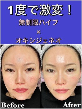 スペチアーレ 夙川/美肌&小顔最強メニュー