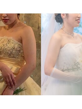 アユアランリンク 札幌店/20代後半/約2ヵ月/ブライダル