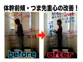 ほねくま整体院 ほねくま接骨院 はりきゅう院 連坊小路院/■施術のbefore after