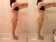 クロレ 浦和店(CLORE)/50代のお客様/9回施術