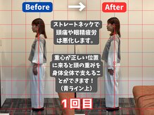 薮下整体院 札幌円山店/30代女性　猫背による眼精疲労