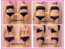 何をやっても痩せないあなた。最後のダイエットしてみませんか？