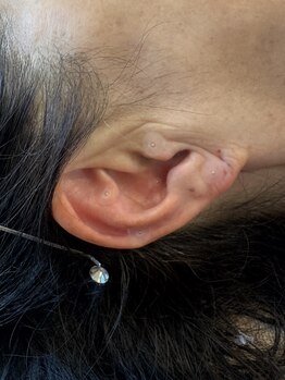 ジュエルオーキッド(Jewel orchids)/耳つぼシンプルデザイン