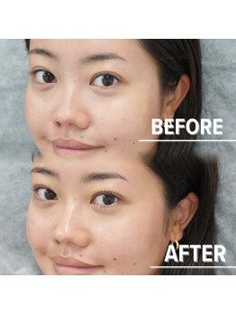 ブリエルアイラッシュ(BRILLER EYELASH)/BROW LIFT&L3 LIFT