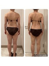 ボーテ(beaute)/【ビフォーアフター】