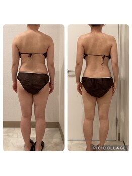 ボーテ(beaute)/【ビフォーアフター】