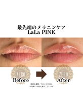 サロンゼロ 池上店(Salon ZERO)/メラニンケア ララピンク リップ