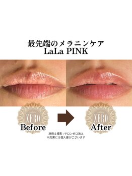サロンゼロ 池上店(Salon ZERO)/メラニンケア ララピンク リップ