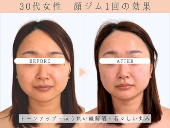 那賀洋子式 顔ジム 大分戸次店/30代女性顔ジム1回の効果