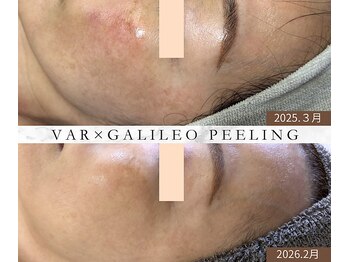 ルームエイトエイティスリー 新宿(R883)/1年のエイジングケアの結果