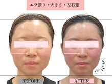 グレースエール トータルビューティーサロン(Grace Aile)の雰囲気(エラ張り・顔の大きさ・左右差)