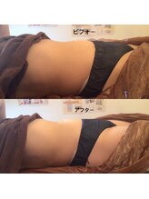 ディア スプリーマ/中半身集中！！お腹スッキリ