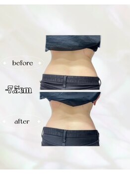 カリス(charis)/Before&After