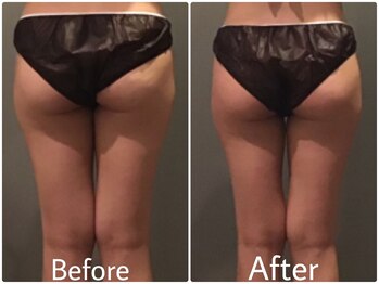 クリスタルビューティー/１回で！！20代