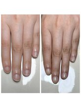 リヒネイル(Rihi.nail)/自爪育成