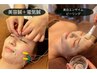 注目【小顔◇美白艶肌】美容鍼+美白エンザイムピーリング＋艶パック¥26400→
