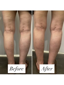 リラル(RERAR)/全身リンパ60分＋ヘッドスパ20分