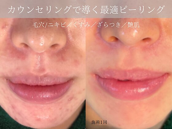 ミューズ バイ エス(MUSE BY S)｜ホットペッパービューティー